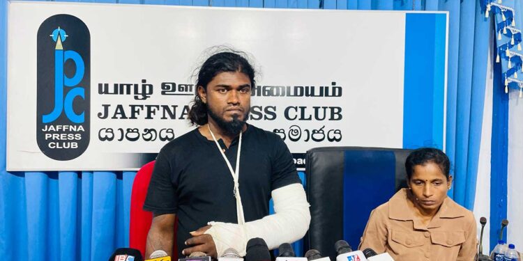 நெல்லியடி பொலிஸார் சித்திரவதை புரிந்ததாக இளைஞன் குற்றச்சாட்டு.