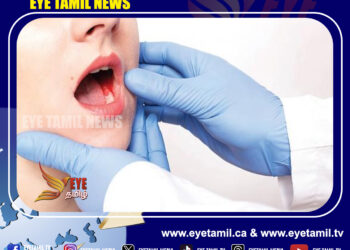 வாய்ப் புற்றுநோய் காரணமாக நாளாந்தம் மூவர் உயிரிழப்பு!
