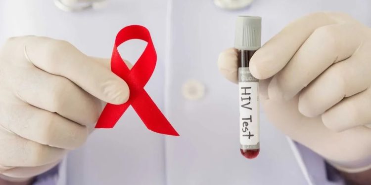 இலங்கையின் எச்.ஐ.வி தொற்றாளர்களின் எண்ணிக்கையில் அதிகரிப்பு!