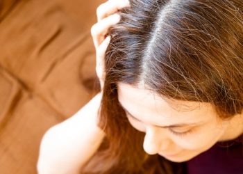 இளநரையால் அவஸ்த்தை படுகிண்றீர்களா ? இதோ நிரந்தரத் தீர்வு